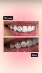 Toothgem modellen gezocht!, Diversen, Ophalen, Nieuw