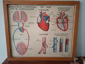 ancienne affiche scolaire double face, Enlèvement