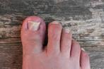 Medische pedicure/manicure Lochristi, Ophalen, Nieuw