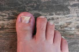 Medische pedicure/manicure Lochristi beschikbaar voor biedingen