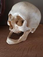 Antieke Schedel Anatomie mens, Ophalen