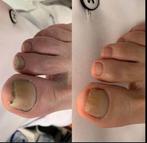 Medische pedicure maandag tem zondag, Ophalen, Zo goed als nieuw
