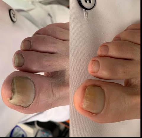 Medische pedicure maandag tem zondag, Handtassen en Accessoires, Uiterlijk | Lichaamsverzorging, Zo goed als nieuw, Ophalen