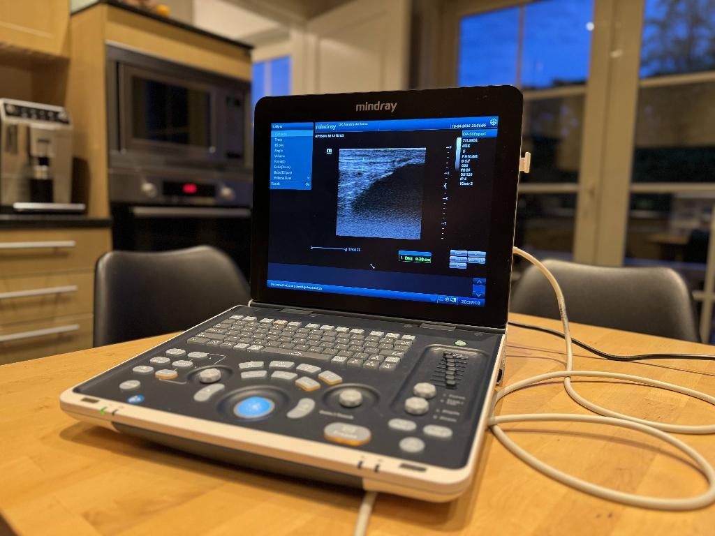 échographe: Mindray DP-50 Expert, Enlèvement, Comme neuf