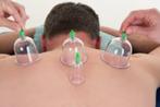 Hijama ou cupping