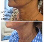 Esthétique soin anti-âge, Ophalen of Verzenden