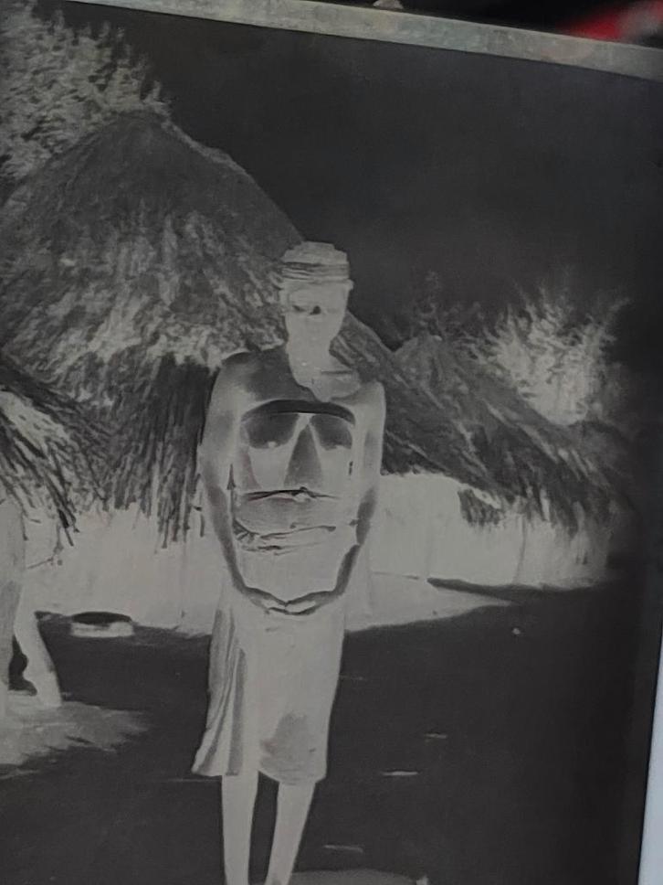 Inheemse verpleegster Katanga Congo 4 foto's 8 negatieven, Verzamelen, Foto's en Prenten, Gebruikt, Foto, Overige onderwerpen