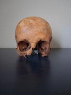 Schedel mens, Ophalen of Verzenden, Gebruikt
