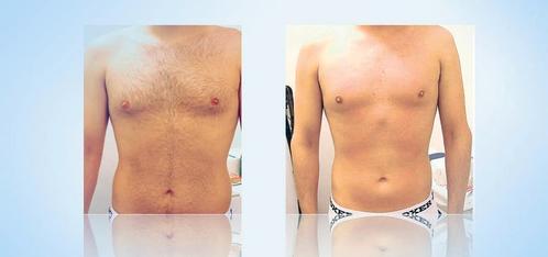 Épilation à la cire et massages pour hommes, Diensten en Vakmensen, Welzijn | Masseurs en Massagesalons, Ontspanningsmassage, Sportmassage