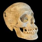 medische schedel mens, Ophalen of Verzenden, Gebruikt
