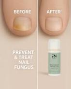 Pronails Nail Fungus Protector Nieuw, Enlèvement ou Envoi, Neuf