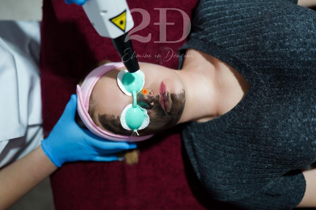 Soin visage Carbone Peeling, Bijoux, Sacs & Beauté, Beauté | Soins du visage, Neuf, Soins, Tout le visage, Enlèvement