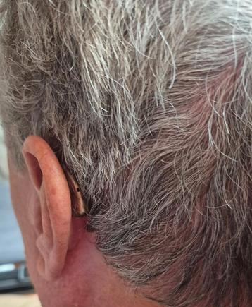 HOORAPPARAAT voor elk oor eentje beschikbaar voor biedingen