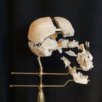 Menselijke beauchene schedel, Verzamelen, Ophalen, Gebruikt, Schedel