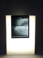 Négatoscope Vintage en Plexiglas - Imagerie Radiologie, Enlèvement ou Envoi