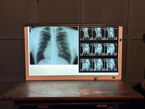 Vintage X-Ray Box (1990s), Antiek en Kunst, Curiosa en Brocante, Ophalen