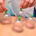 Massage en cupping therapy, Sportmassage