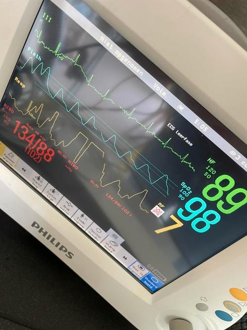 Philips PM30 monitor, Sport en Fitness, Gezondheidsproducten en Wellness, Gebruikt, Ophalen