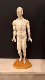 Vintage pop met acupunctuur meridianen, Ophalen