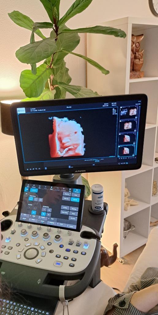 Echografie 3d4d, Diversen, Overige Diversen, Nieuw, Ophalen of Verzenden