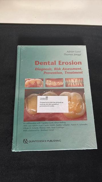 Boek Dental Erosion beschikbaar voor biedingen