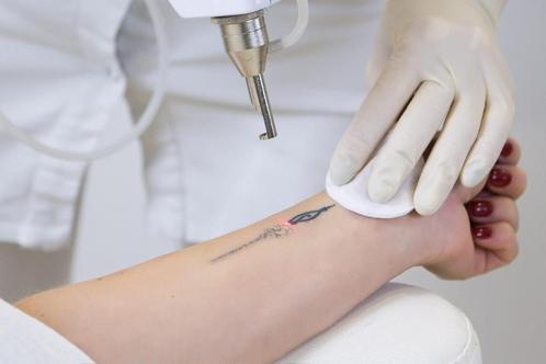 Tattoo en/ of PMU wenbrauwen verwijdering, Diversen, Verpleegmiddelen, Zo goed als nieuw, Ophalen