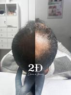 ✨ Verzorg je haar in Brussel ✨, Stoelmassage