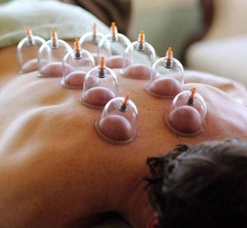 Hijama beschikbaar voor biedingen
