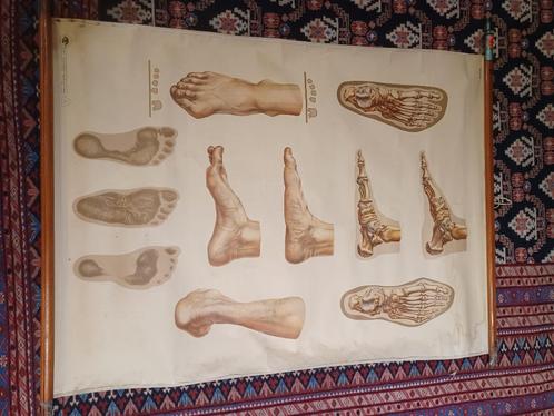 Medische schoolplaat, Antiek en Kunst, Curiosa en Brocante, Ophalen