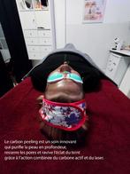Soin visage Carbone Peeling, Enlèvement, Neuf, Tout le visage, Nettoyage