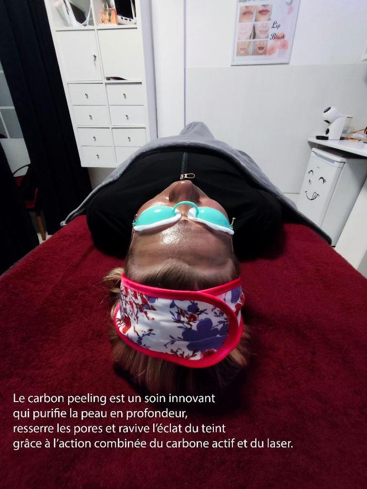 Soin visage Carbone Peeling, Bijoux, Sacs & Beauté, Beauté | Soins du visage, Neuf, Nettoyage, Tout le visage, Enlèvement