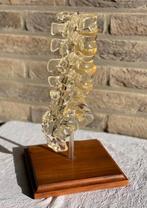 Didactisch model Lumbale wervelkolom anatomie wervels, Ophalen of Verzenden