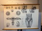 Schoolplaat zwangerschap, Antiquités & Art, Antiquités | Cartes scolaires, Enlèvement