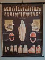 Rétro. Affiche de l'école. Dents, Enlèvement, Utilisé