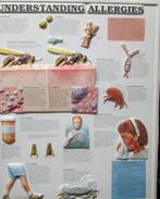 Medische plaat "Allergies" (kunststof), Antiek en Kunst, Antiek | Schoolplaten, Natuur en Biologie, Ophalen of Verzenden