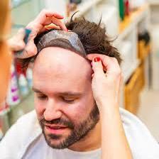 Haarprothese onderhoud (pruik).. 7/24, Diensten en Vakmensen, Haarkappers