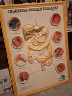 anatomie, Enlèvement