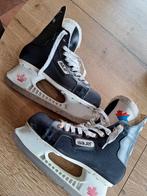 Patins à glace bauer, Enlèvement