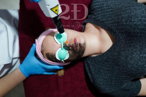!! Promo!! Carbone Peeling gezichtsverzorging, Handtassen en Accessoires, Uiterlijk | Gezichtsverzorging, Nieuw, Verzorging, Gehele gezicht