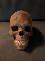 Schedel mens. Voor educatieve doeleinden., Ophalen of Verzenden
