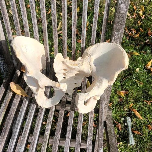 Menselijk bekken met vergroeiing, Antiek en Kunst, Curiosa en Brocante, Ophalen of Verzenden