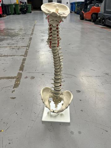 Anatomisch model wervelkolom met bekken en hernia beschikbaar voor biedingen