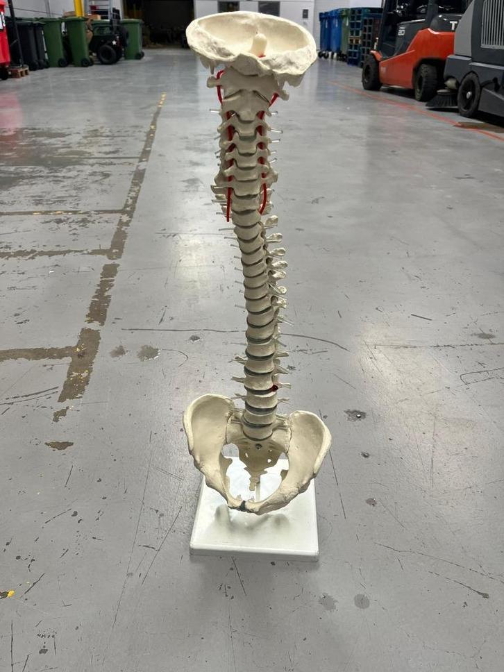 Anatomisch model wervelkolom met bekken en hernia, Diversen, Schoolbenodigdheden, Zo goed als nieuw, Ophalen