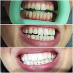 100%beauty blanchiment dentaire