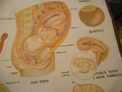 oude medische schoolkaarten  zwangerschap, Antiek en Kunst, Antiek | Schoolplaten, Ophalen of Verzenden