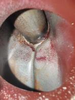 Batavus M56, Autres modèles, 1 vitesses, 49 cm³, Classe B (45 km/h)