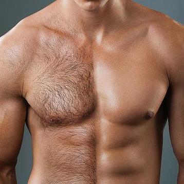 Permanente ontharing mannen en vrouwen. beschikbaar voor biedingen