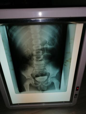 retro negatoscope uit dokterspraktijk beschikbaar voor biedingen