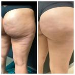 Anti-cellulite massage, Ophalen, Zo goed als nieuw