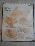 oude zwangerschapskaart/poster, Ophalen of Verzenden